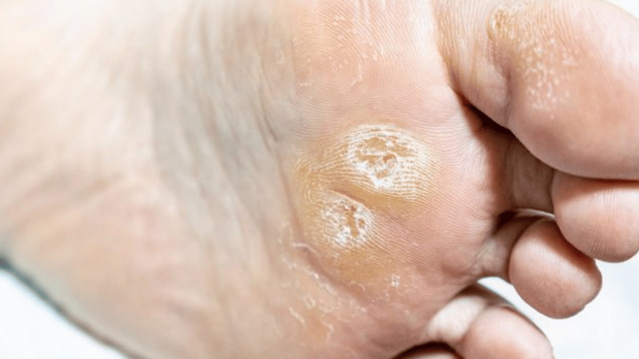 Foto - İbn-i Sina bin yıl önceden onu açıkladı, bin yıllık reçete! Mutlaka bunu uygulayın ve...