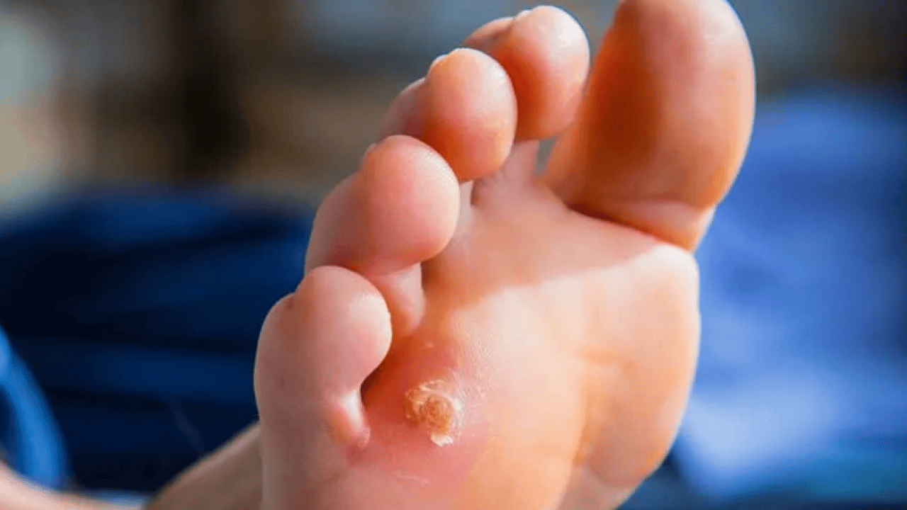 Foto - İbn-i Sina bin yıl önceden onu açıkladı, bin yıllık reçete! Mutlaka bunu uygulayın ve...