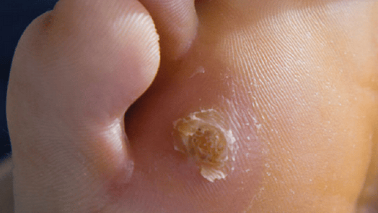 Foto - İbn-i Sina bin yıl önceden onu açıkladı, bin yıllık reçete! Mutlaka bunu uygulayın ve...