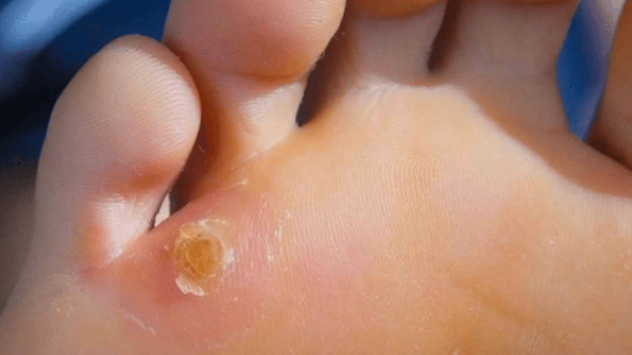 Foto - İbn-i Sina bin yıl önceden onu açıkladı, bin yıllık reçete! Mutlaka bunu uygulayın ve...