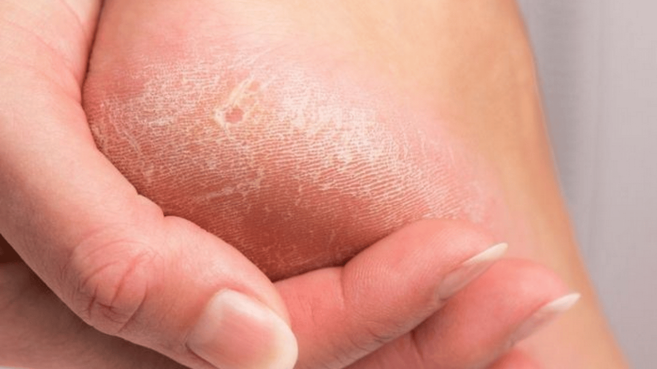 Foto - İbn-i Sina bin yıl önceden onu açıkladı, bin yıllık reçete! Mutlaka bunu uygulayın ve...