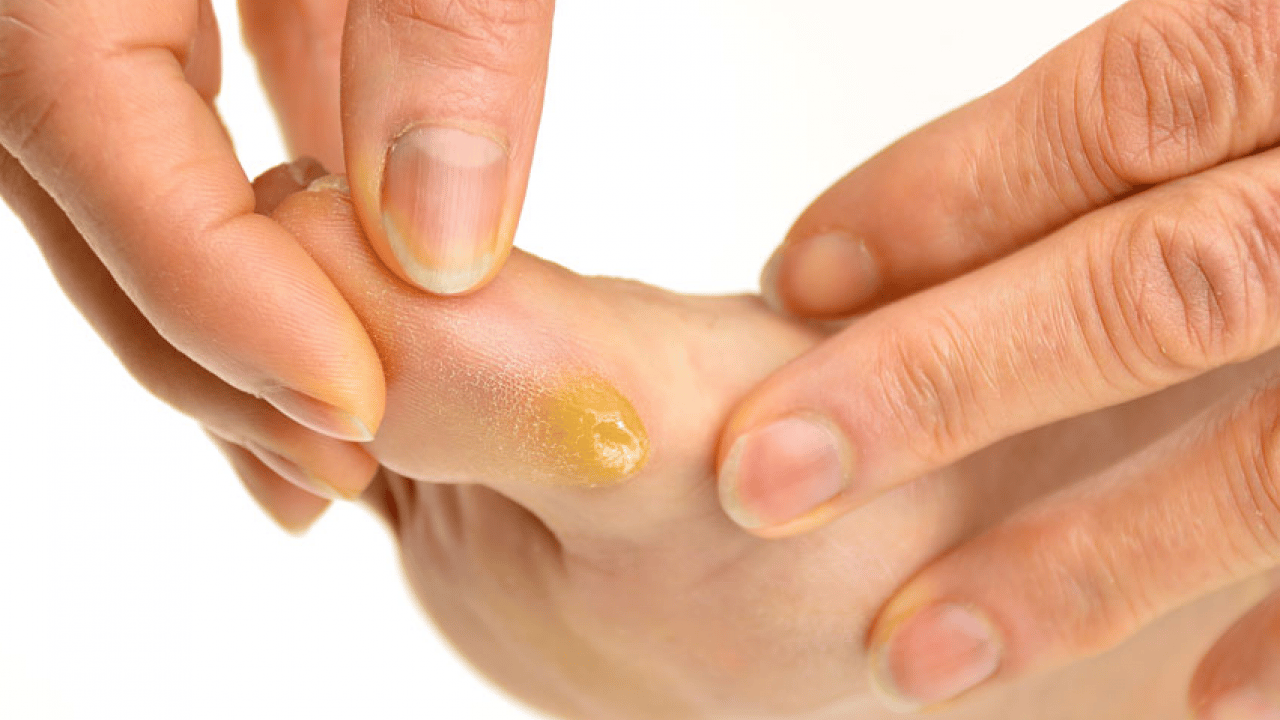 İbn-i Sina bin yıl önceden onu açıkladı, bin yıllık reçete! Mutlaka bunu uygulayın ve...