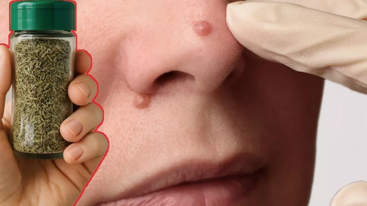 Foto - İbn-i Sina'nın siğillere formülü: Ne kurt bırakıyor ne mikrop! Siğillere karşı önerdiği bitki! 