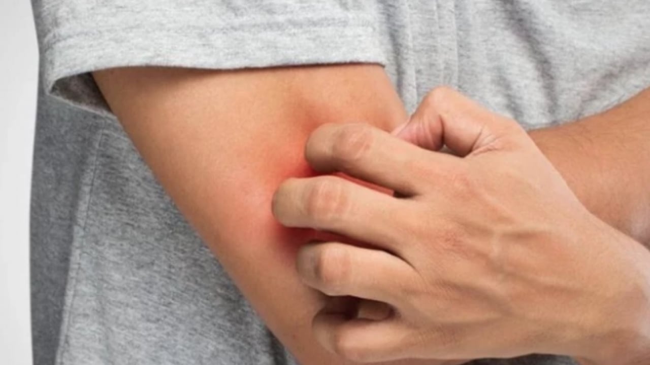 Foto - İbni Sina’nın şifası burada: Asırlık egzama sırrı: Şifalı kısmını çöpe atıyormuşuz! Meğer mucizevi gizli gücü varmış