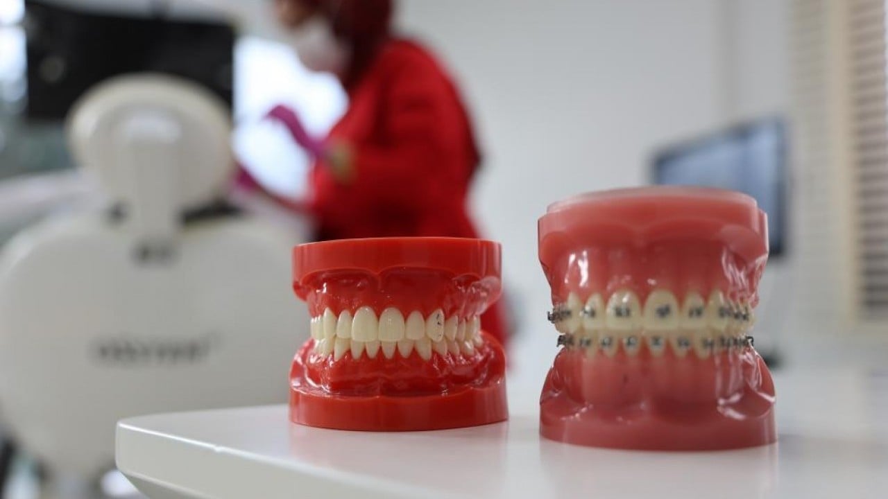 Foto - İftardan sahura bardak bardak çay içenler dikkat