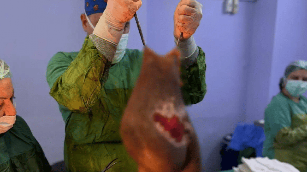Foto - ikinci kez anne olunca başladı: 32 yıl 40 kiloyu karnında taşıdı!