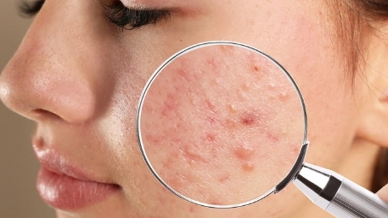 Foto - İlaç talebi bıçak gibi kesildi! Ciltlere kurtarıcı dokunuş... İşte cilt sorunlarına yöntemler