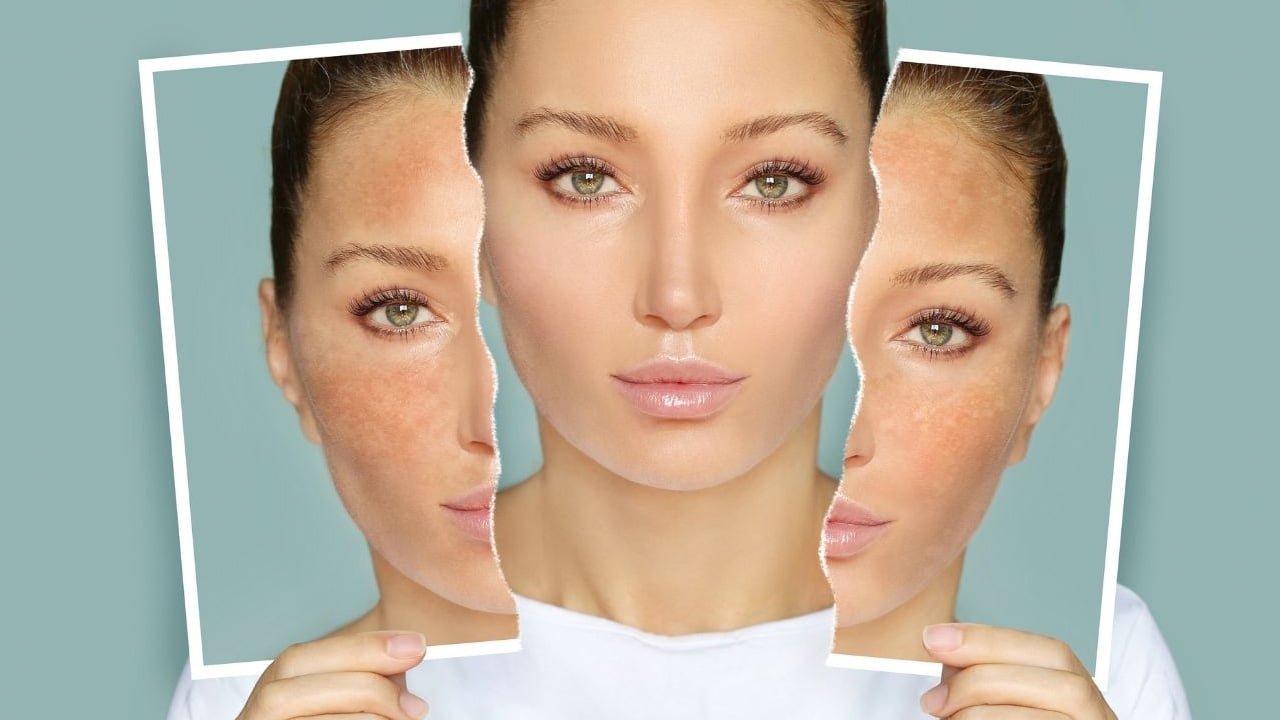 Foto - İlaç talebi bıçak gibi kesildi! Ciltlere kurtarıcı dokunuş... İşte cilt sorunlarına yöntemler