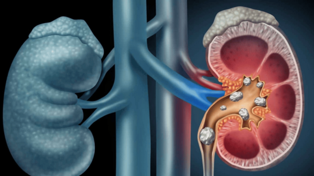 Foto - İlginç gelişme olur hayatımızda sonra... Tansiyon ve böbrek hastalığı: birbirini etkileyen iki sessiz sorun