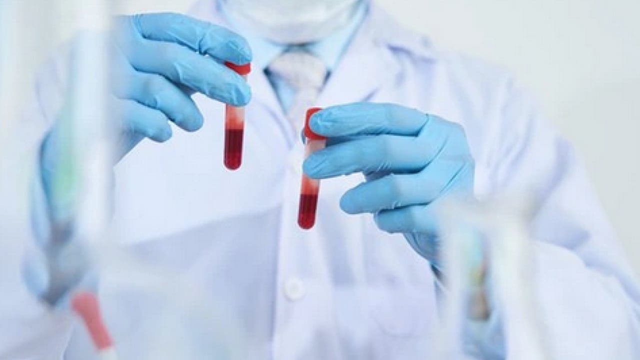 Foto - İlk 3'te görülen kanser türleri: Hangi Belirtiler Kansere İşaret Edebilir?