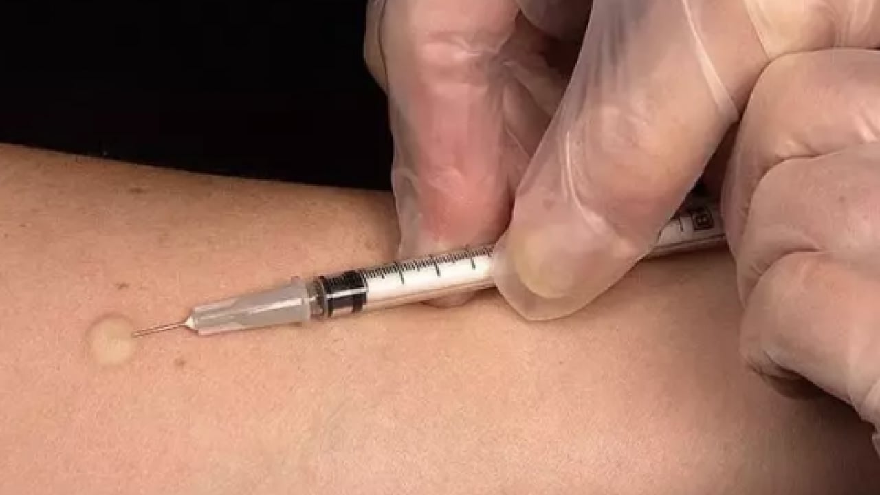 Foto - İmmün yetmezliği: Erken tanı ve doğru takip hayat kurtarıyor! İmmünsüpresif detayı...