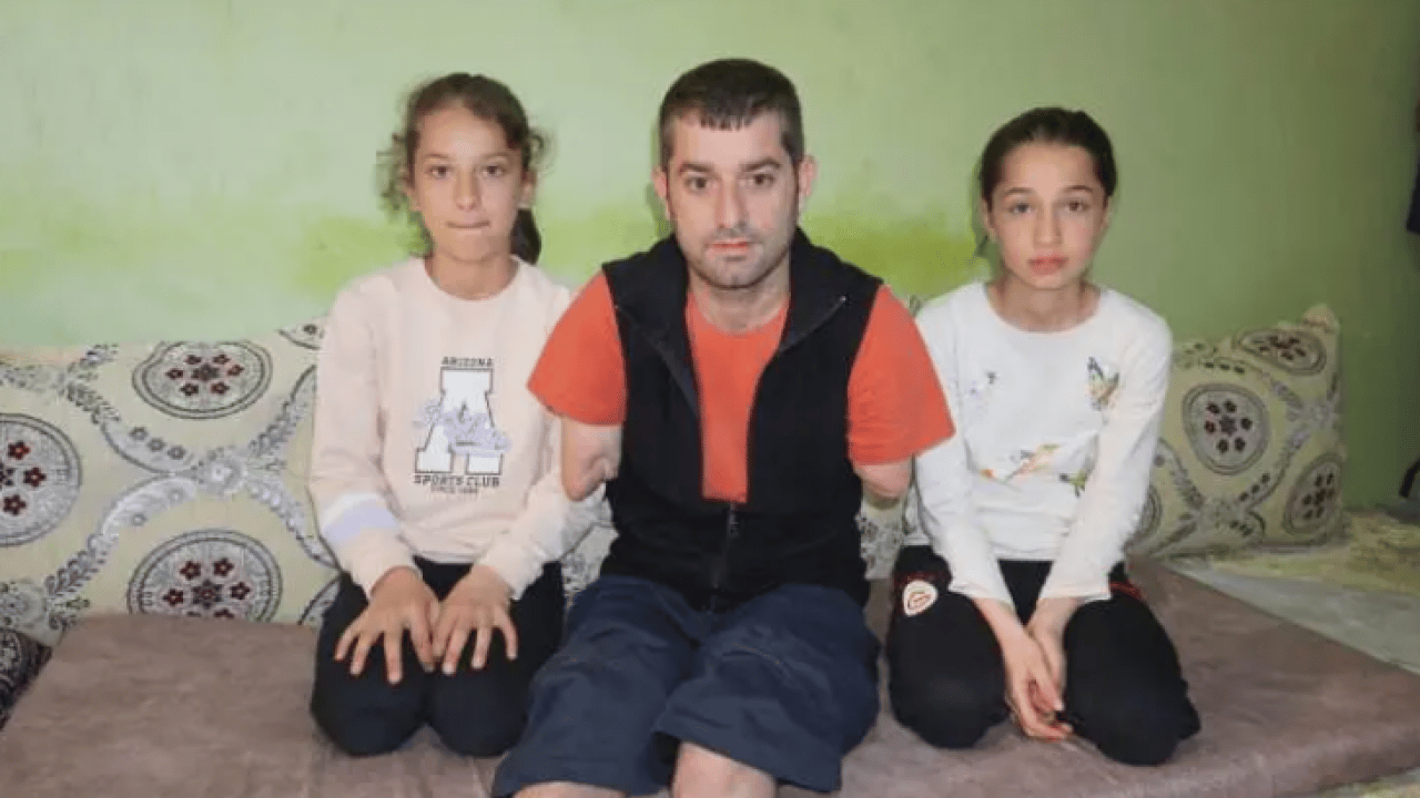 Foto - İş kazasında kolları ve ayaklarını kaybetti! Paylaştığı video hayatını değiştirdi!