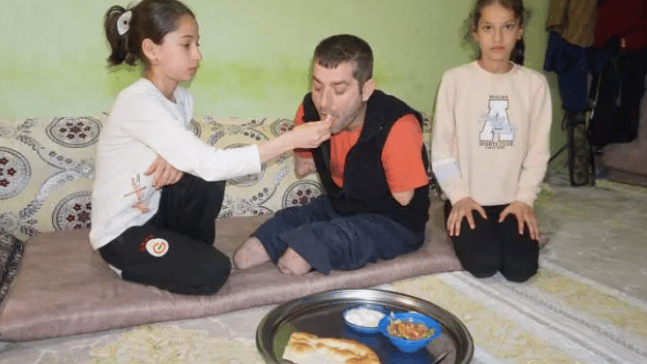 İş kazasında kolları ve ayaklarını kaybetti! Paylaştığı video hayatını değiştirdi!