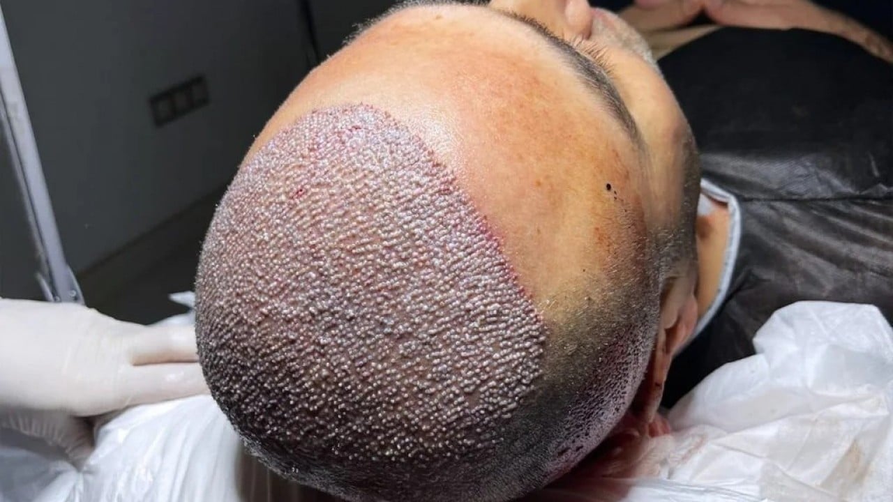 Foto - İşi bizden öğrenip karşımıza çıktılar! Rusya bir anda Türkiye'ye rakip oldu