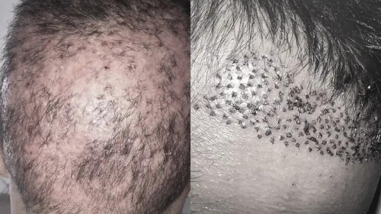 Foto - İşi bizden öğrenip karşımıza çıktılar! Rusya bir anda Türkiye'ye rakip oldu