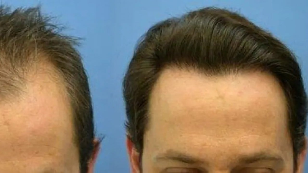 Foto - İşi bizden öğrenip karşımıza çıktılar! Rusya bir anda Türkiye'ye rakip oldu