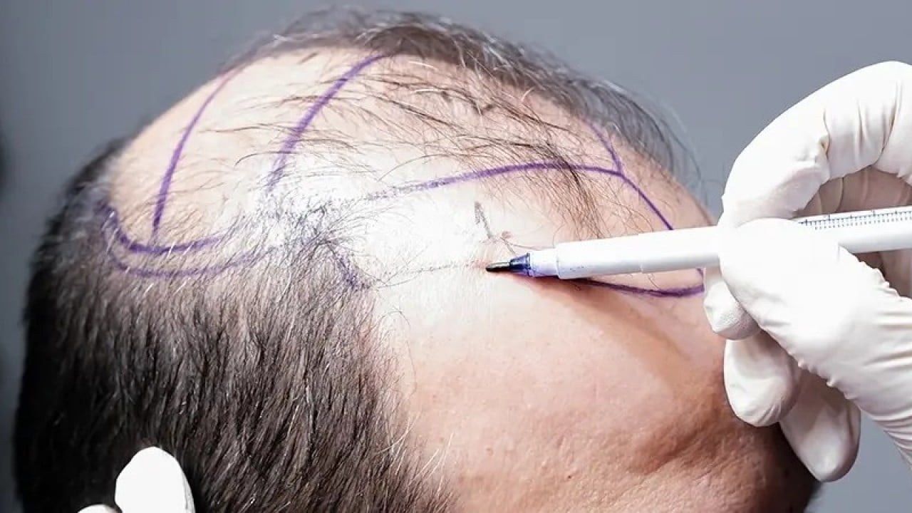 Foto - İşi bizden öğrenip karşımıza çıktılar! Rusya bir anda Türkiye'ye rakip oldu