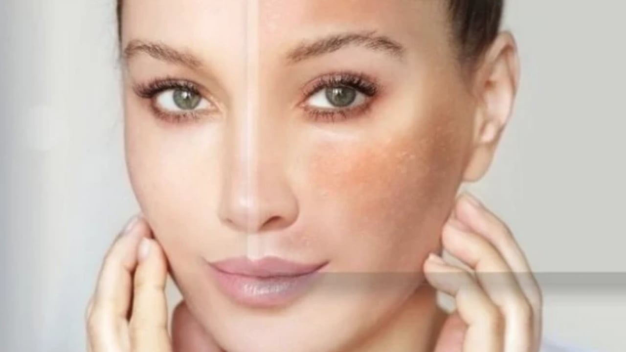 Foto - Işıl ışıl bir görünüme var mısınız? Cilt lekelerine kabak mucizesi