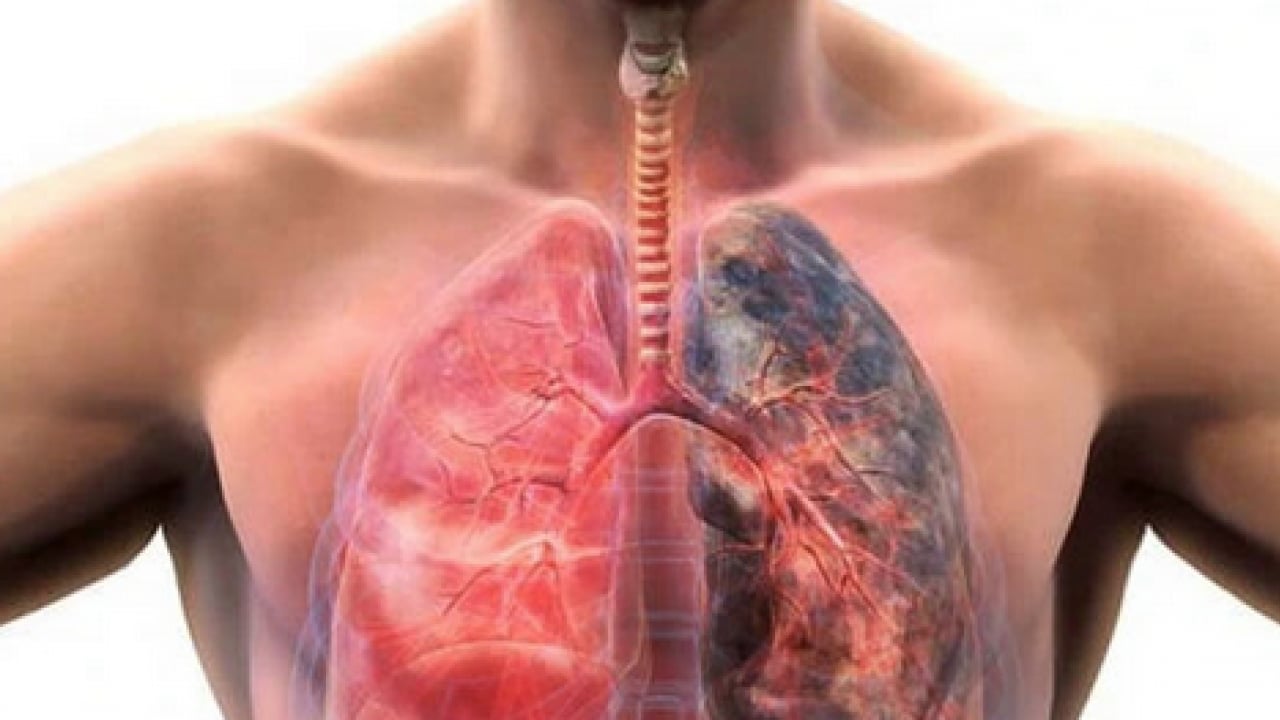 Foto - İşin ucu yine sigaraya dayanıyor: Uzmanından dünyada en çok öldüren 4'üncü hastalık için uyarı