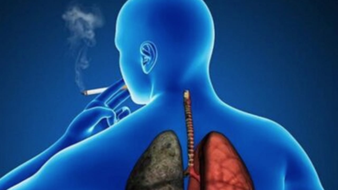 Foto - İşin ucu yine sigaraya dayanıyor: Uzmanından dünyada en çok öldüren 4'üncü hastalık için uyarı