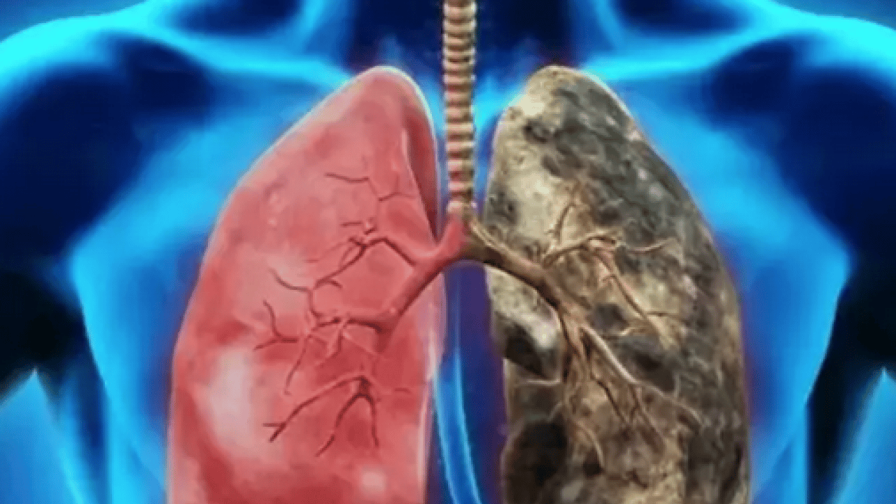 Foto - İşin ucu yine sigaraya dayanıyor: Uzmanından dünyada en çok öldüren 4'üncü hastalık için uyarı