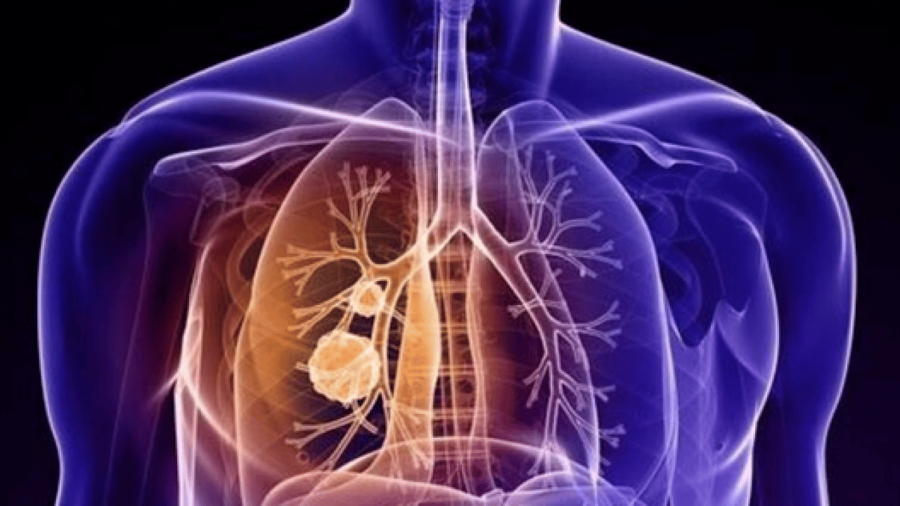 Foto - İşin ucu yine sigaraya dayanıyor: Uzmanından dünyada en çok öldüren 4'üncü hastalık için uyarı