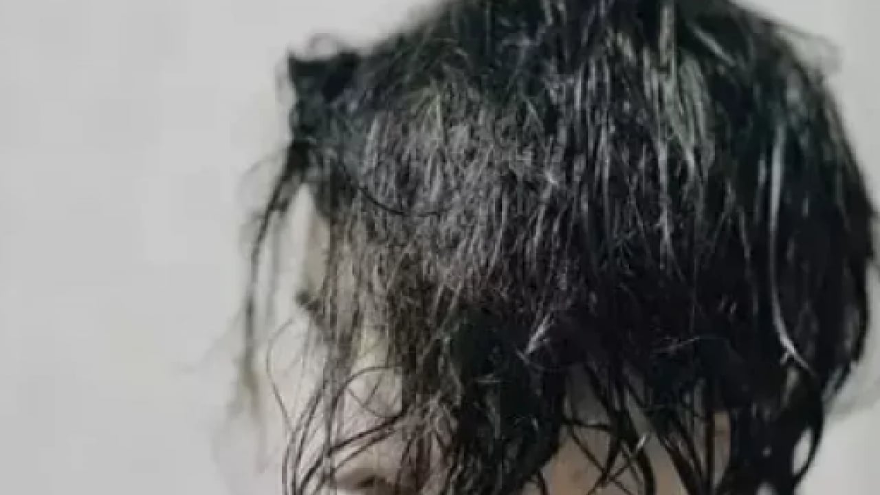 Foto - Islak saç ile uyumak sorun mu? Sinüzit yapar mı? Sorunla ilgili uzmanların kritik uyarısı