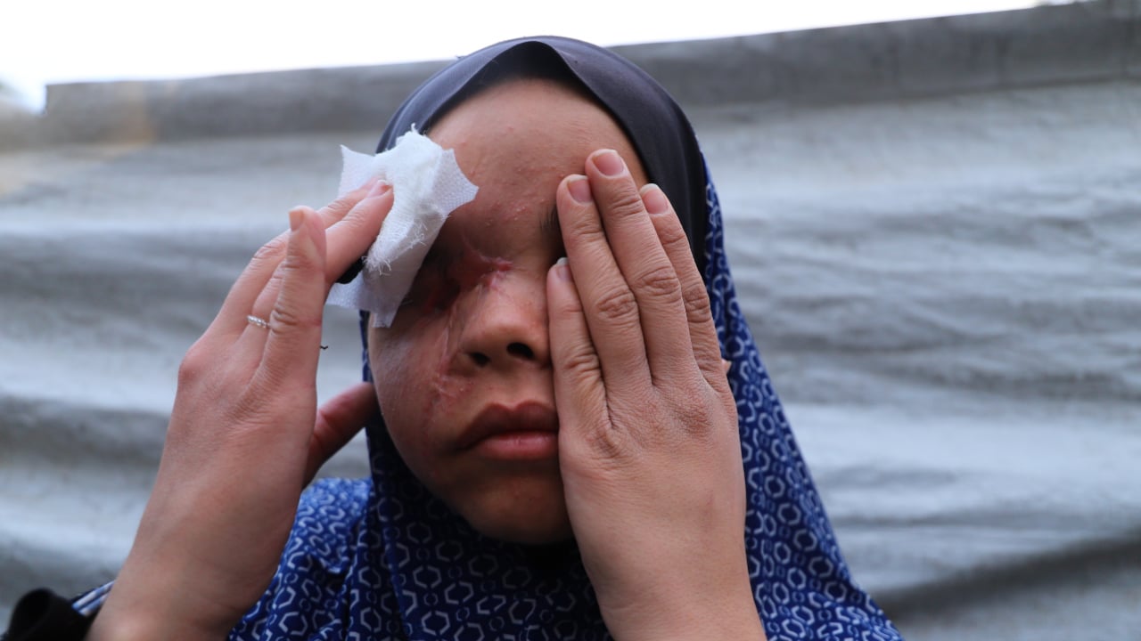Foto - İsrail bombaları Neda’yı karanlığa mahkum etti! Oyun oynarken dünyası başına yıkıldı