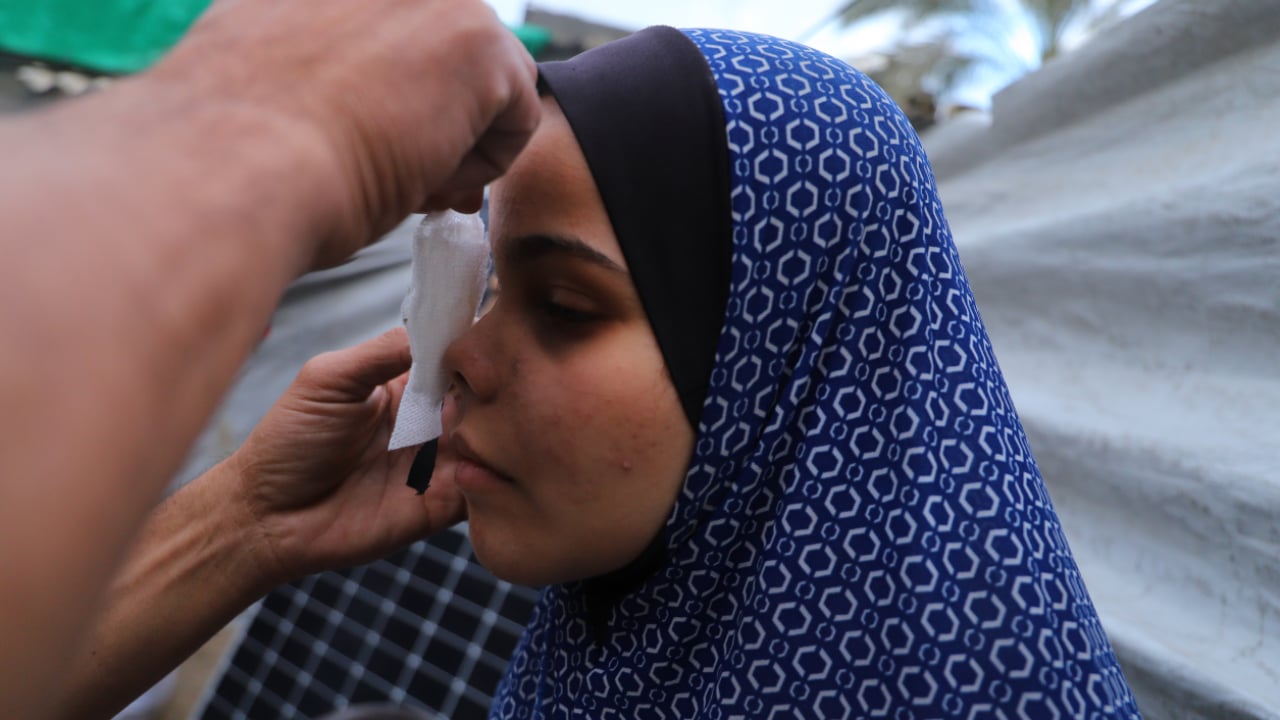 Foto - İsrail bombaları Neda’yı karanlığa mahkum etti! Oyun oynarken dünyası başına yıkıldı