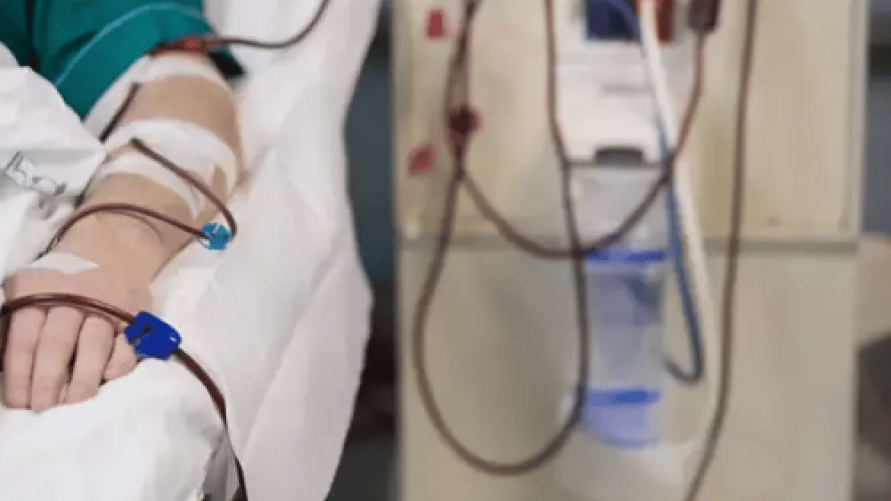 Foto - İstanbul'da hayata bağlayan rakam! Her gün 11 bin hasta diyaliz merkezlerine emanet 