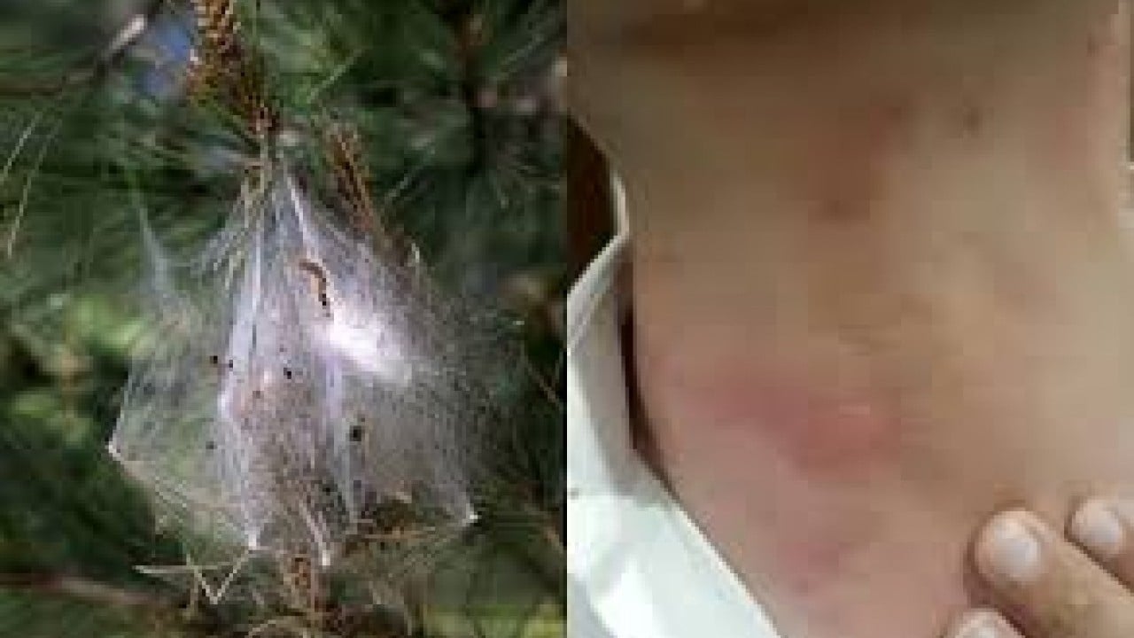 Foto - İstanbul’da kâbus başladı! Dokunanın dili çürüyor, sakın yaklaşmayın