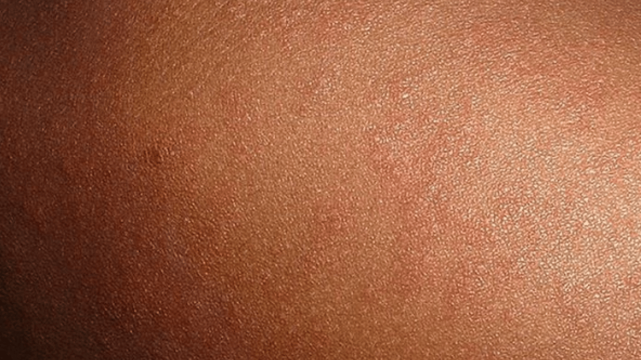 Foto - İstanbul’da korkutan salgın! Vakalar hızla artıyor