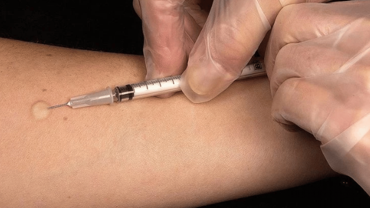 Foto - İstanbul’da kuduz alarmı! En fazla vakanın görüldüğü ilçeler belli oldu