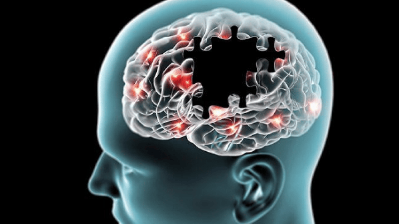 Foto - İşte bu hiç beklenmiyordu: Duygusal hafıza direniyor: Alzheimer'da ribot kanunu