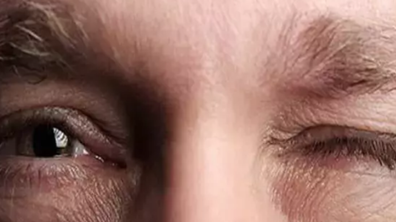 İşte bu istemsiz hareketin sebebi... Stresin yardım çağrısı: Göz seyirmesi neden olur?