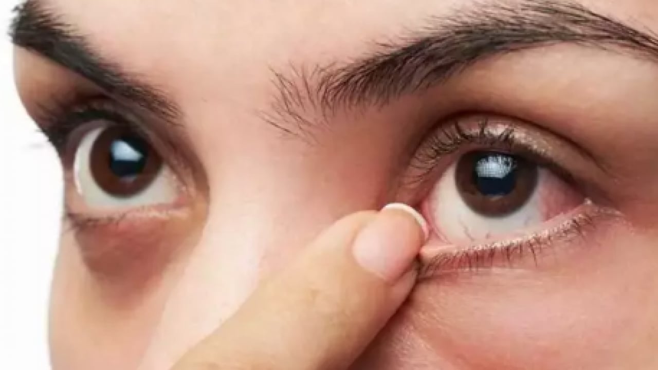 Foto - İşte bu istemsiz hareketin sebebi... Stresin yardım çağrısı: Göz seyirmesi neden olur?