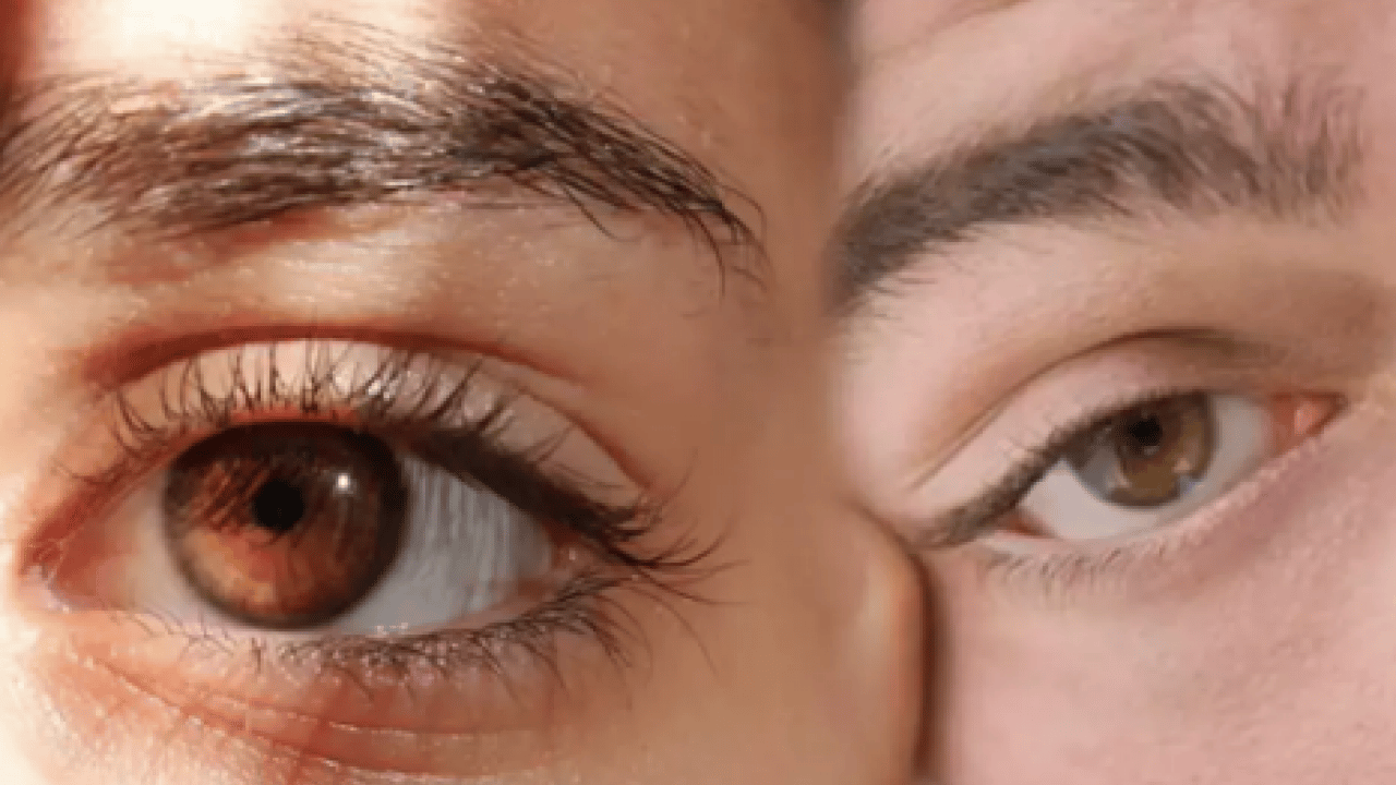 Foto - İşte bu istemsiz hareketin sebebi... Stresin yardım çağrısı: Göz seyirmesi neden olur?