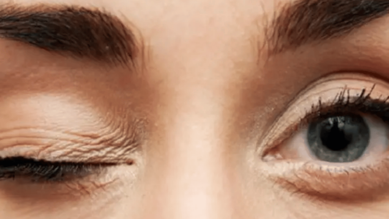 Foto - İşte bu istemsiz hareketin sebebi... Stresin yardım çağrısı: Göz seyirmesi neden olur?