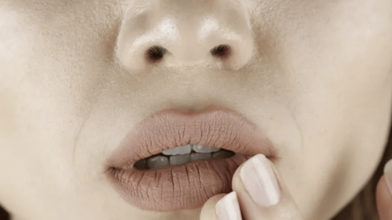 Foto - İşte doğal yöntemlerle bu havalarda korunmanın yolu: Dudak çatlaklıklarına birebir çözüm!