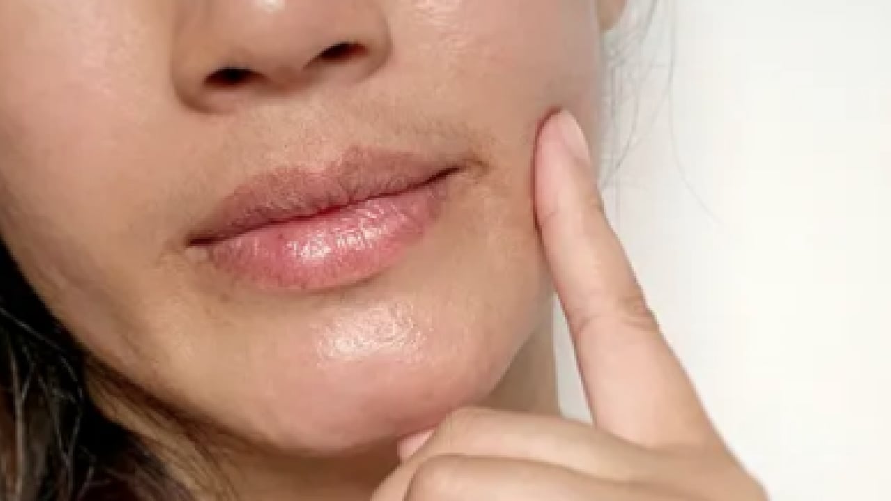 Foto - İşte doğal yöntemlerle bu havalarda korunmanın yolu: Dudak çatlaklıklarına birebir çözüm!