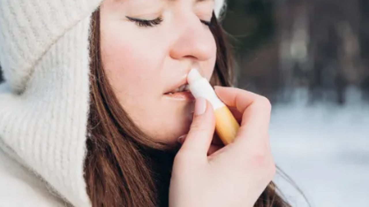 Foto - İşte doğal yöntemlerle bu havalarda korunmanın yolu: Dudak çatlaklıklarına birebir çözüm!