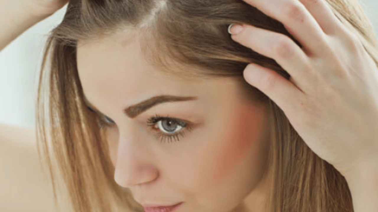 Foto - İşte saç dökülmesinin temel problemi! Artık bu konu önemsenmeli... 