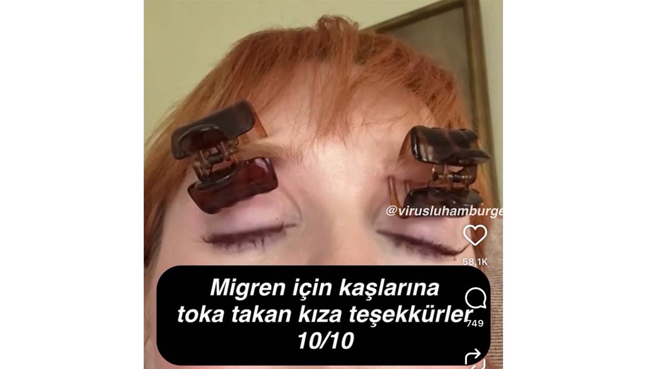 Foto - İyice moda oldu! Migreni geçirmenin yolu bu kadar kolay mı?