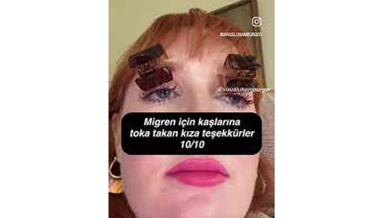 Foto - İyice moda oldu! Migreni geçirmenin yolu bu kadar kolay mı?