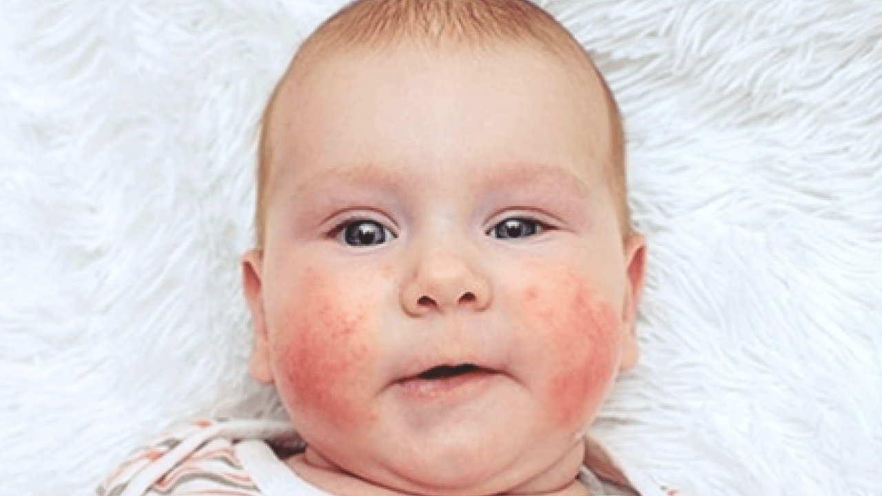 Foto - JAMA'dan dikkat çeken araştırma sonuçları: Her 20 çocuktan birinde 6 yaşına kadar...