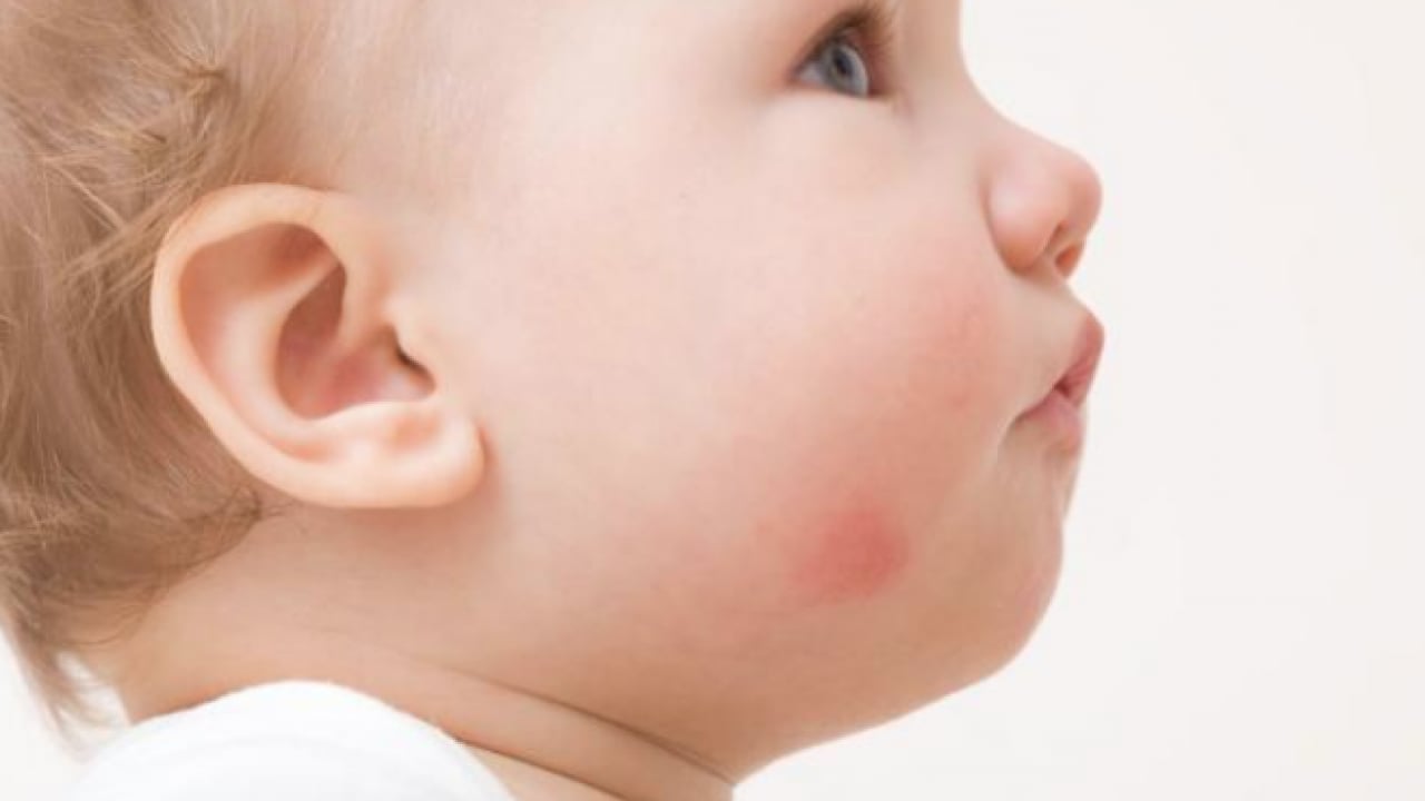 Foto - JAMA'dan dikkat çeken araştırma sonuçları: Her 20 çocuktan birinde 6 yaşına kadar...