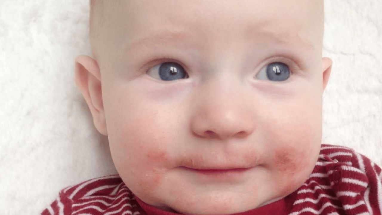 Foto - JAMA'dan dikkat çeken araştırma sonuçları: Her 20 çocuktan birinde 6 yaşına kadar...