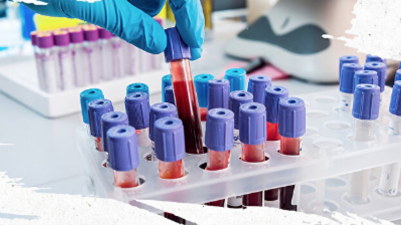 Foto - Japon bilim adamları açıkladı! Zeka fışkıran kan grubu: Japonya'da çok yaygın, başarılı oluyorlar En zeki ve akıllı kan grubu 