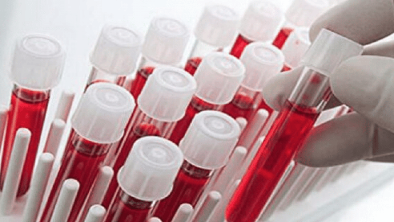 Foto - Japon bilim adamları açıkladı! Zeka fışkıran kan grubu: Japonya'da çok yaygın, başarılı oluyorlar En zeki ve akıllı kan grubu 