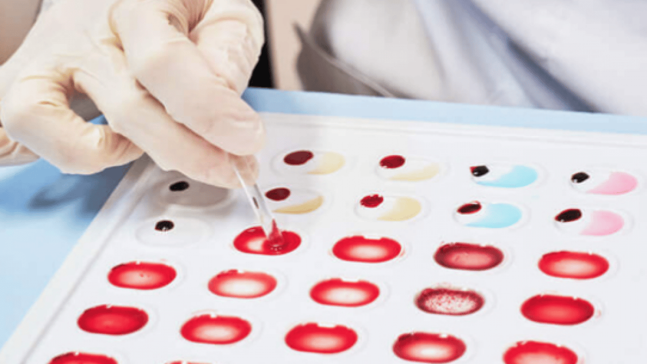 Japon bilim adamları açıkladı! Zeka fışkıran kan grubu: Japonya'da çok yaygın, başarılı oluyorlar En zeki ve akıllı kan grubu 